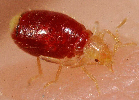 Bed bug bite