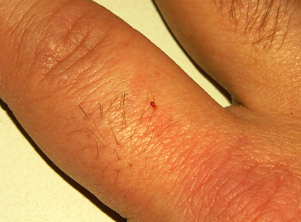 Larva di cimice