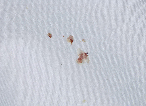 Macchie di sangue sulla biancheria da letto