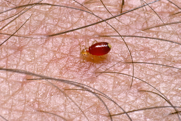 Larva di cimice