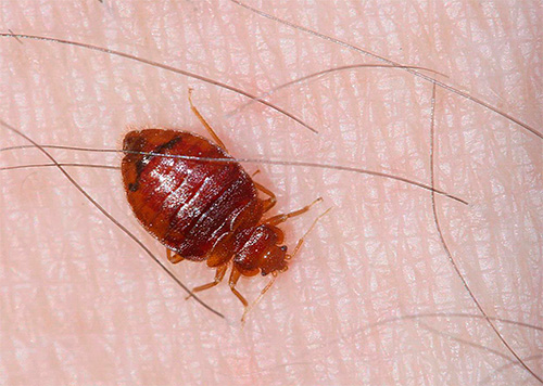 Get to know the symptoms of bed bug bites