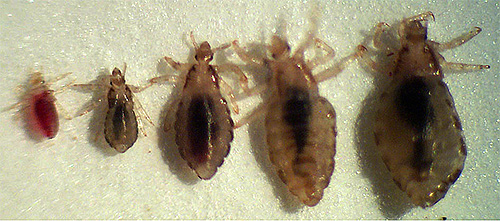In the photo - an adult head louse and nymphs of different ages
