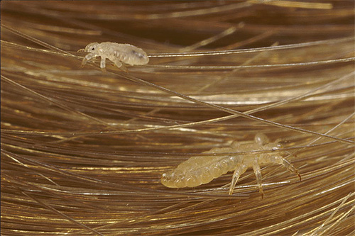 Adult head louse and nymph