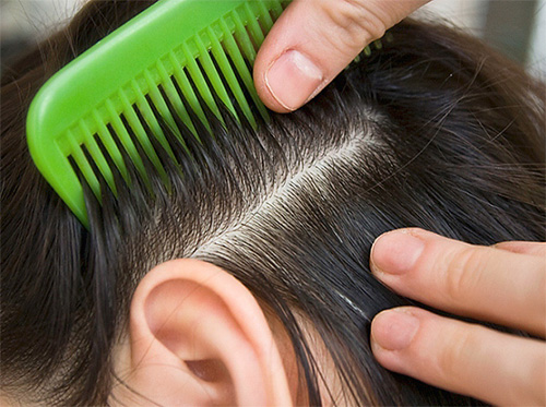 Crowds favor the transmission of head lice (both head lice and linen lice)