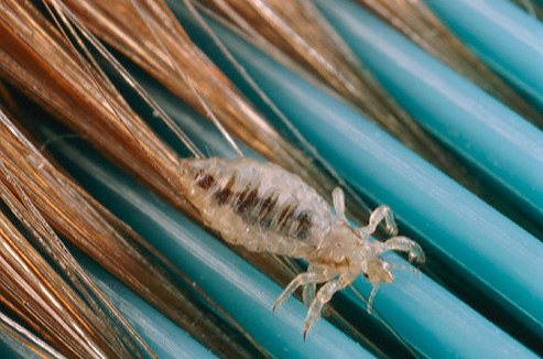 No species of human lice is capable of jumping.