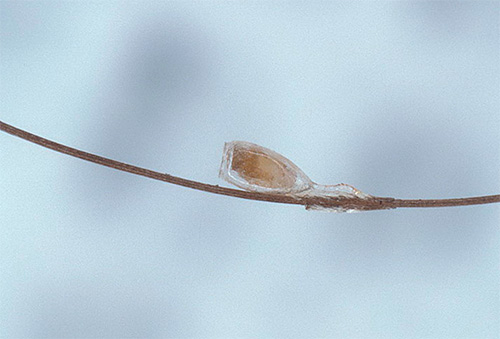 La foto mostra che le lendini sono saldamente incollate ai capelli.