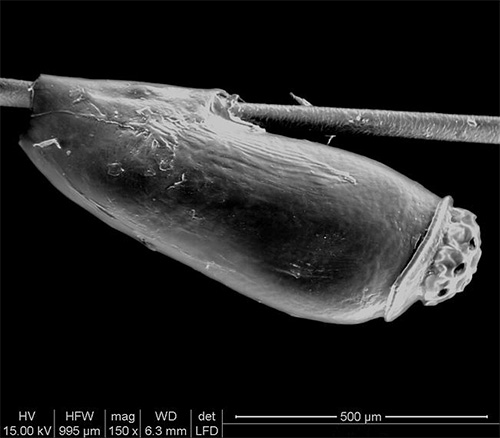 Ecco come appare una lendine al microscopio elettronico