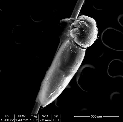 Nella foto, una larva di pidocchio si schiude dalle lendini