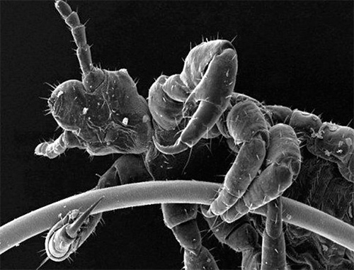 Photographie d'un pou de tête au microscope