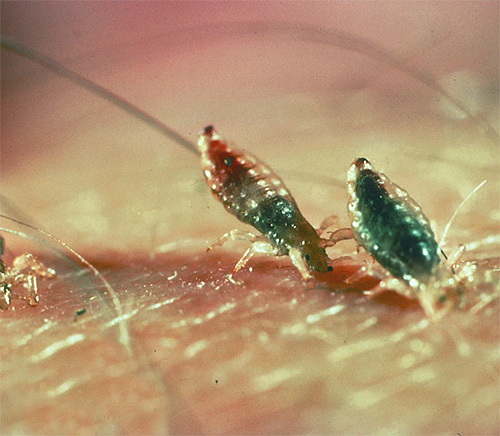 Several linen lice