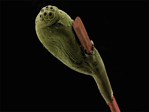 Photographie de lentes au microscope électronique