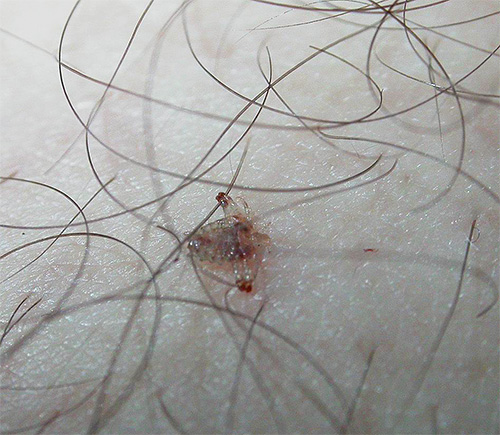 Piolho pubiano no corpo