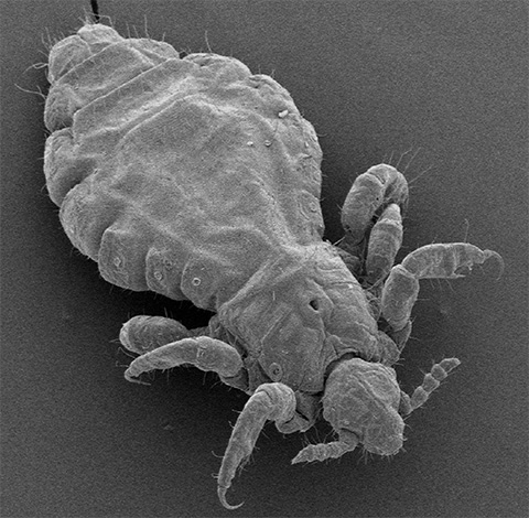 É assim que um piolho se parece sob um microscópio eletrônico