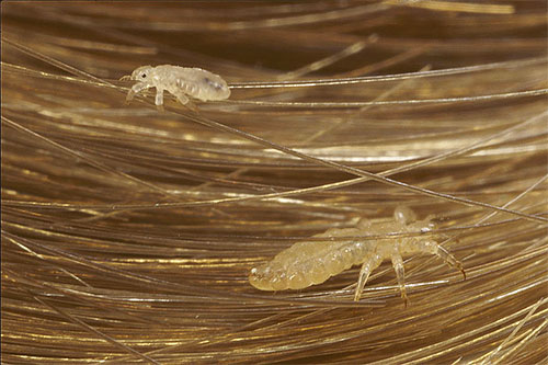 Lice on the hair - the most common image of these parasites in dreams