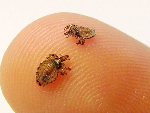 Crushing lice in a dream can be a favorable sign