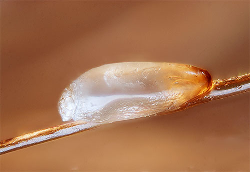 Proviamo a capire quali metodi per rimuovere le lendini dai capelli sono i più efficaci e allo stesso tempo sicuri da usare.