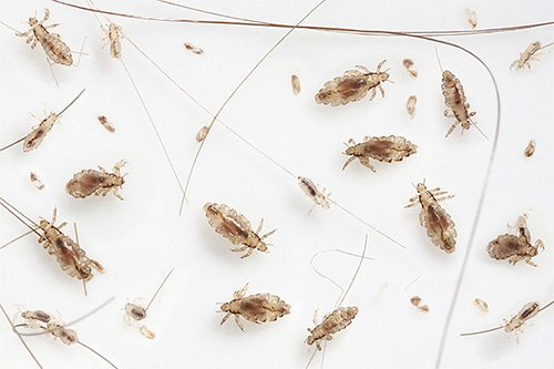 La foto mostra pidocchi e lendini pettinati con un pettine (sono chiaramente visibili su un panno bianco)