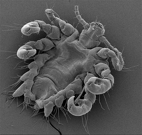 อีกรูปของ pubic louse ใต้กล้องจุลทรรศน์อิเล็กตรอน