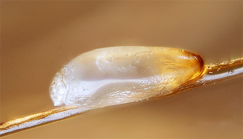 Les lentes de poux sont protégées par une coquille spéciale, de sorte que même de nombreux moyens modernes ne sont pas capables de les tuer.