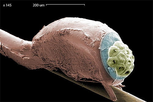 Photographie de lentes au microscope