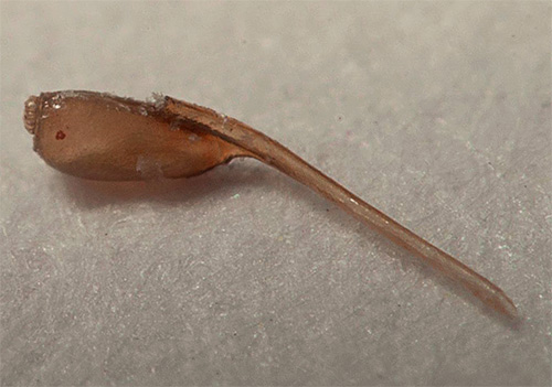 Psychoanalysis considers lice and nits in a dream as a distorted image of problems.