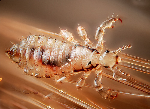 The interpretation of dreams with lice and nits for different people can vary significantly