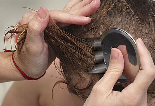 Peigner les poux et les lentes avec un peigne n'est pas une procédure facile, mais assez efficace.