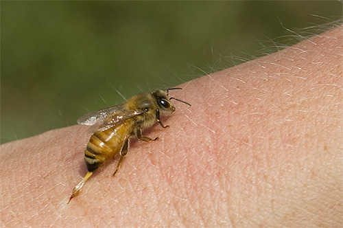 Sia il veleno d'api che il veleno di calabrone sono altamente allergenici.