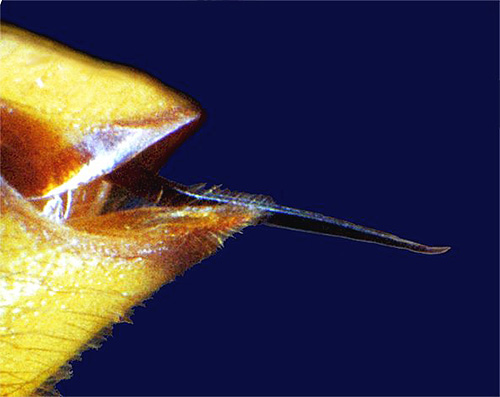The photo shows a hornet sting under a microscope