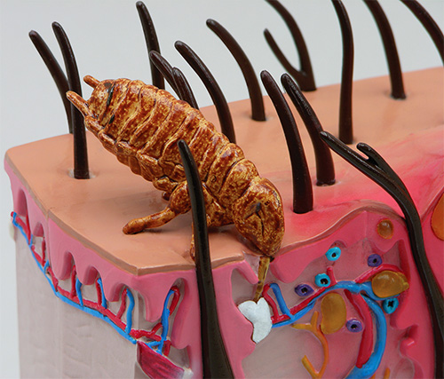 The insect pierces the skin with special bristles to get to the blood vessel.