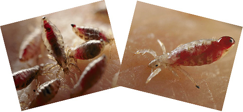 Let's talk about what lice bites look like, as well as their potential danger to humans ...