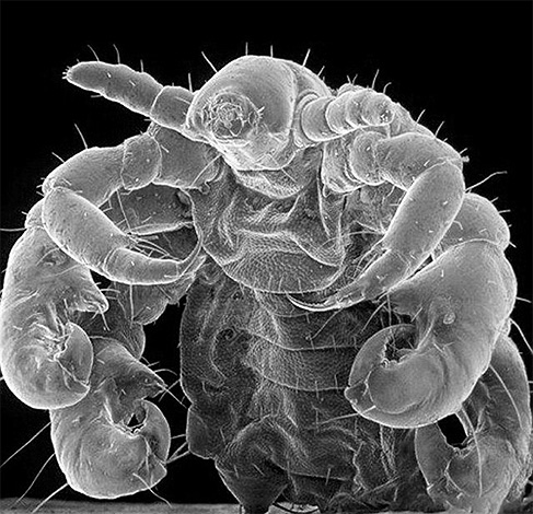 And this is a photograph of a louse under an electron microscope