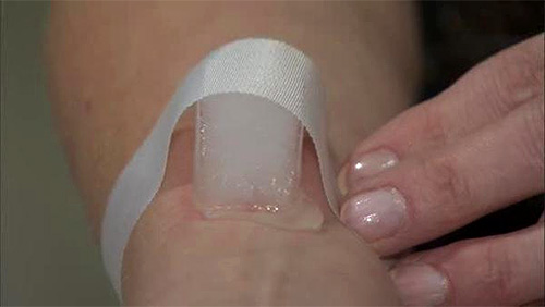 If you apply ice to the place bitten by the wasp, this will help reduce the severity of edema.