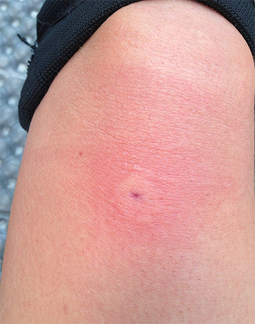 If you were stung by a wasp in nature, you can use one of the folk remedies.