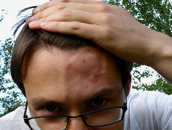 When getting rid of wasps, always remember that they can bite you hard.