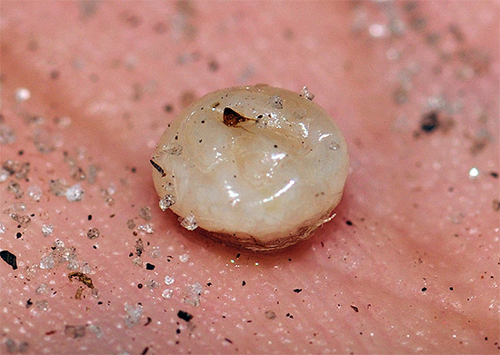 Et voici à quoi ressemble une puce de sable femelle, pleine d'œufs extraits de sous la peau.