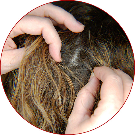 Aujourd'hui, vous pouvez vous débarrasser assez rapidement des poux et des lentes dans vos cheveux, littéralement en 1 jour - nous en reparlerons plus tard ...
