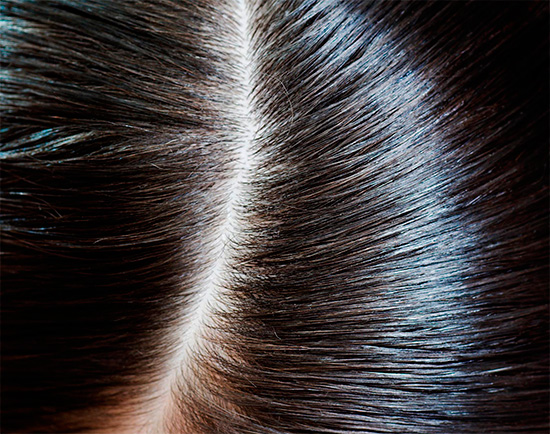 Après la procédure, il n'y aura même pas de lentes sèches dans les cheveux.
