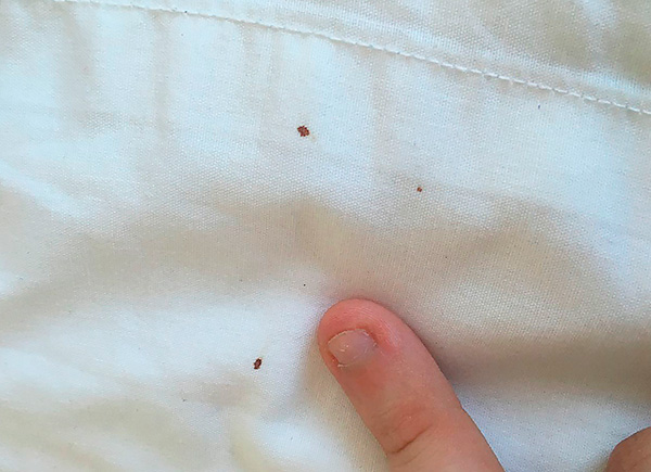 È anche utile eseguire esami preventivi delle lenzuola: la presenza di tracce di sangue su di esse può indicare la comparsa di parassiti in casa.