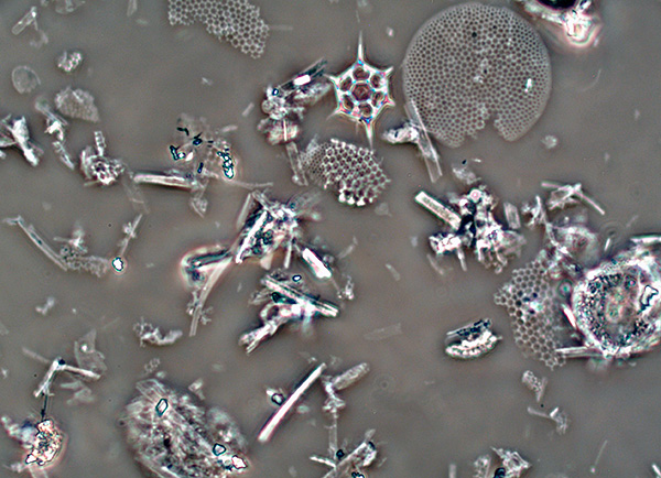 Particelle di diatomite al microscopio.