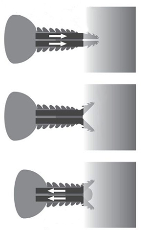L'image montre schématiquement le fonctionnement de l'appareil buccal de la tique de la taïga lors d'une morsure.