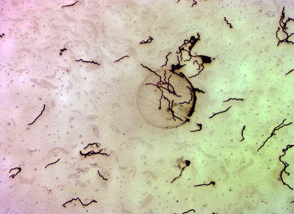 Borrelia burgdorferi ภายใต้กล้องจุลทรรศน์ (กำลังขยาย 400x)