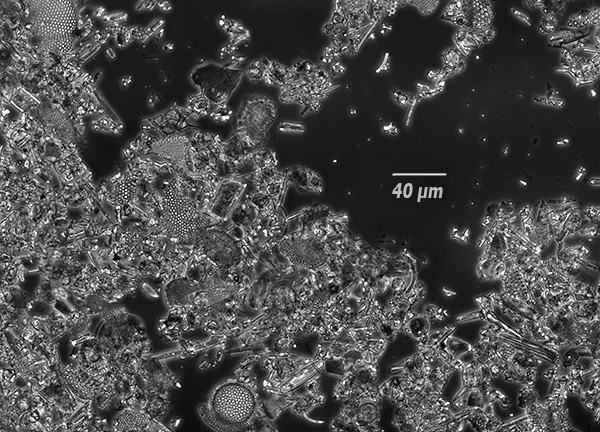 Ecco come appare la diatomite al microscopio.