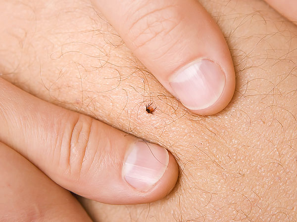 It is very difficult to grasp such a small tick correctly with your fingers, especially if your nails are cut short.