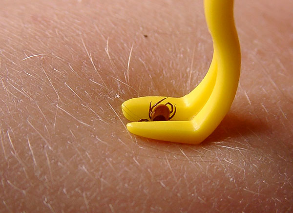 The groove in the device allows you to fix the body of the parasite, so that when it rotates, it also begins to rotate in the wound and unhooks.