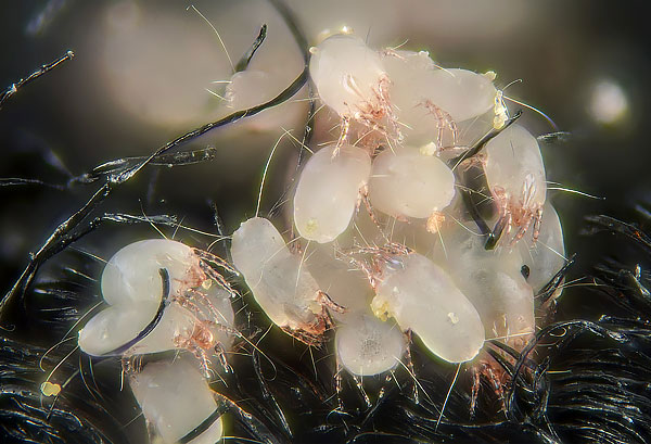 Les acariens Dermatophagoides pteronyssinus sont presque impossibles à repérer à l'œil nu dans un tapis, c'est pourquoi la plupart des gens supposent qu'ils ne sont pas dans la maison.