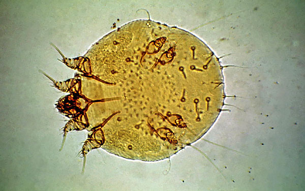 Les démangeaisons de la gale rongent activement les passages de la peau, ce qui provoque des démangeaisons sévères et des lésions dermatologiques caractéristiques.