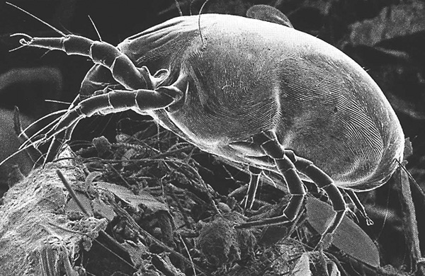 Dermatophagoides pteronyssinus (photo prise au microscope électronique à balayage).
