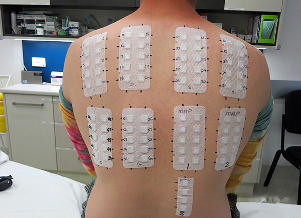 Un esempio di utilizzo di un patch test