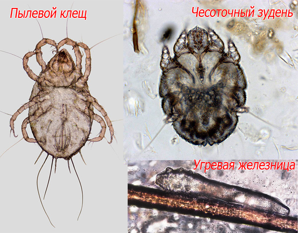 Ecco come appaiono al microscopio gli acari della polvere, la scabbia e le ghiandole dell'acne.